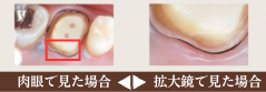 拡大鏡